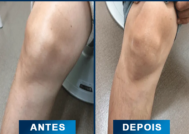 5 comparativo-otimizado