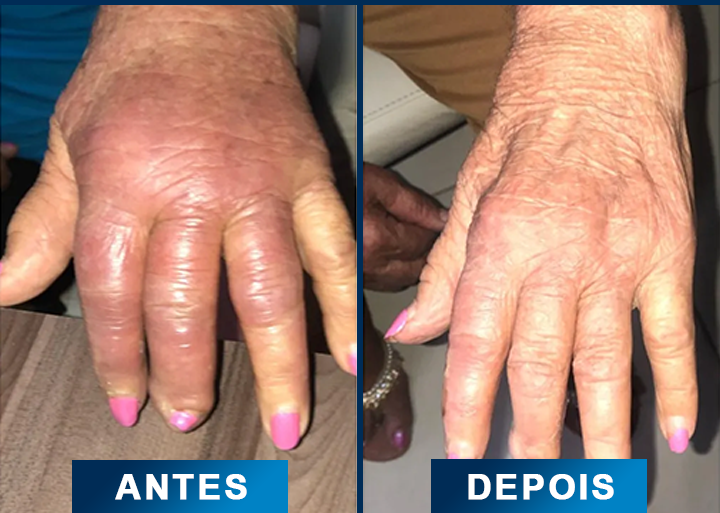 5 comparativo-otimizado