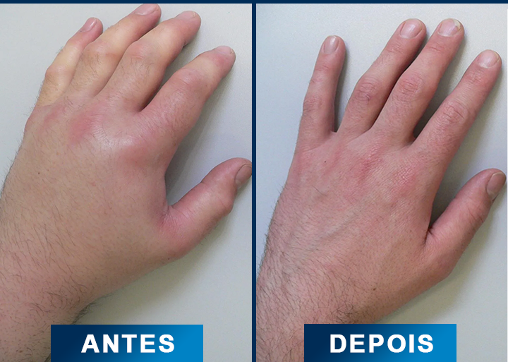 5 comparativo-otimizado