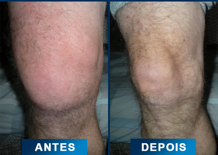 5 comparativo-otimizado