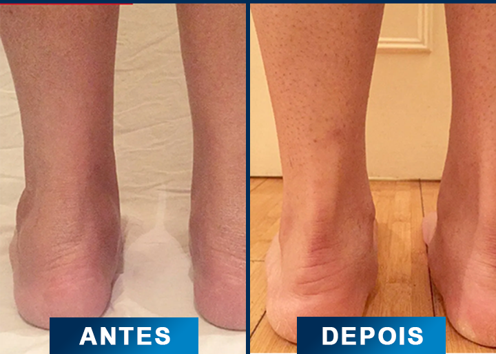 5 comparativo-otimizado